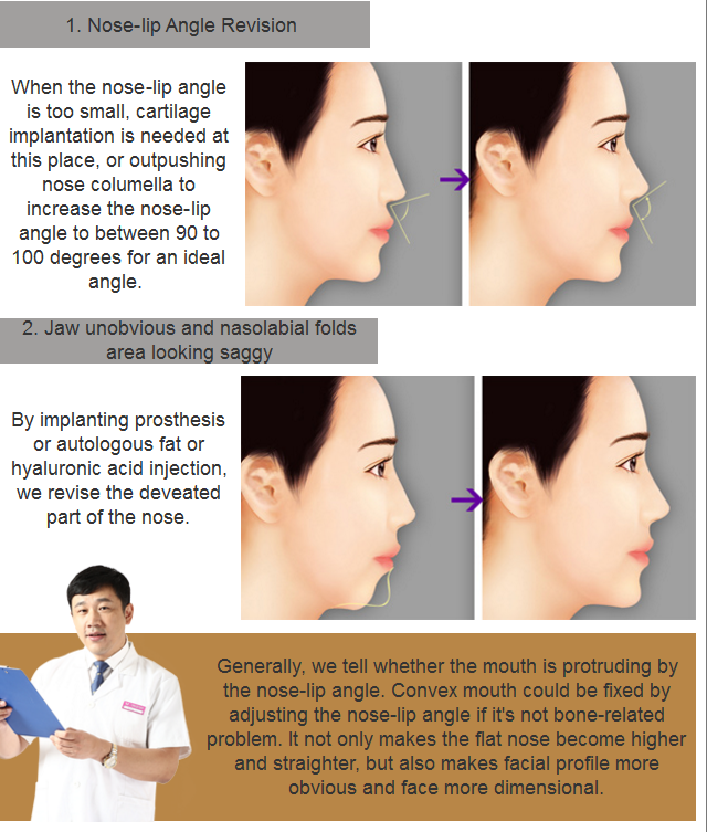 two general convex mouth surgery