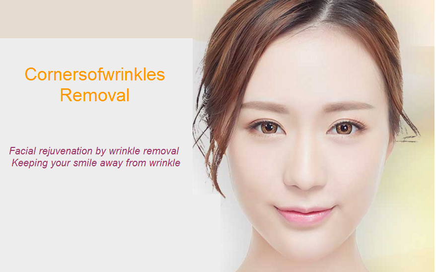 cornersofwrinkles removal