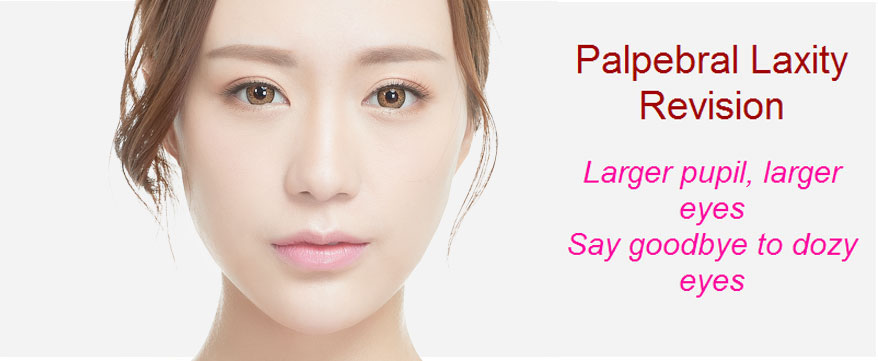 palpebral laxity