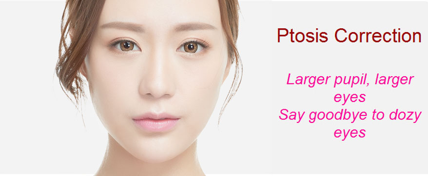 ptosis correction