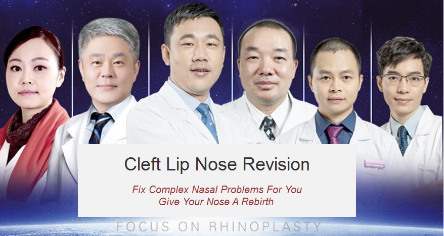 Cleft Lip Nose Revision