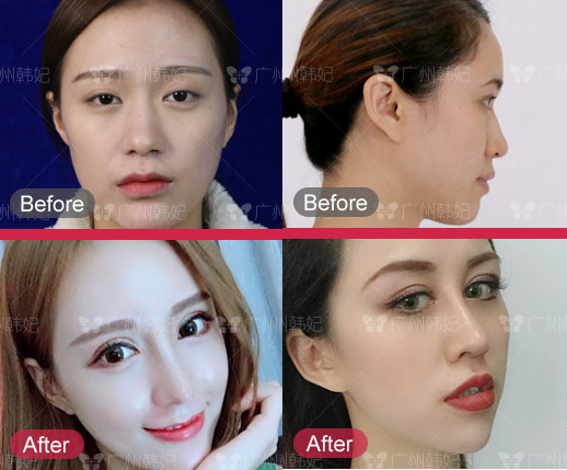 eye anti-aging