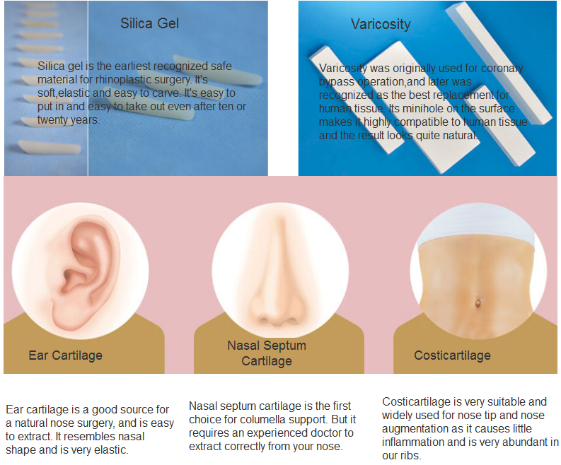 deformed nose revision